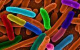 Bệnh E.coli  ở thuỷ cầm